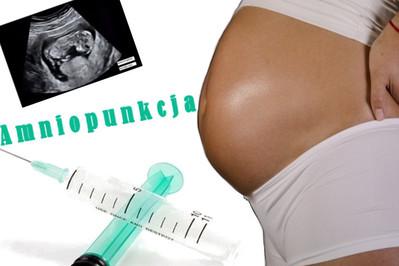 Amniopunkcja tylko dla zwolenniczek aborcji? – OBALAMY MITY