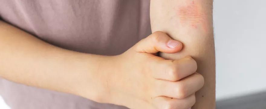 Bariera hydrolipidowa skóry - dlaczego jej odbudowa to klucz do zdrowej, spokojnej skóry