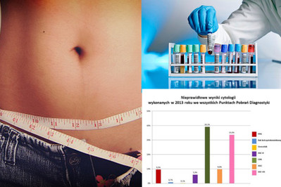 ZESPÓŁ METABOLICZNY  - dotyczy już co czwartej Polki! Ważna jest szybka diagnoza!